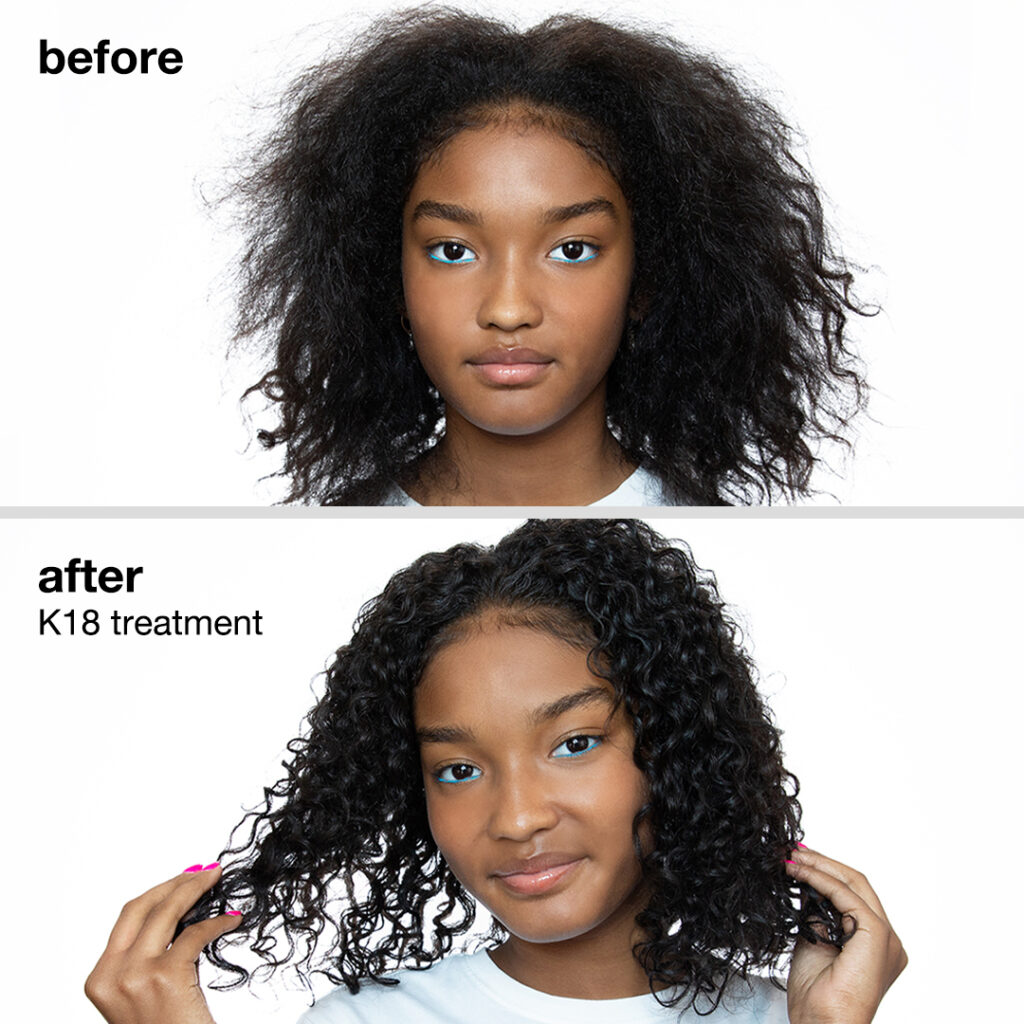 K18 – Before & After – Social
